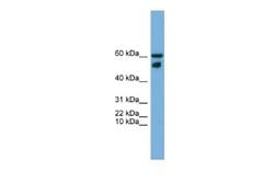 ZNF765 Rabbit anti-Human, Polyclonal, Novus Biologicals 0.1 mL | Buy Online | Novus Biologicals | Fisher Scientific
